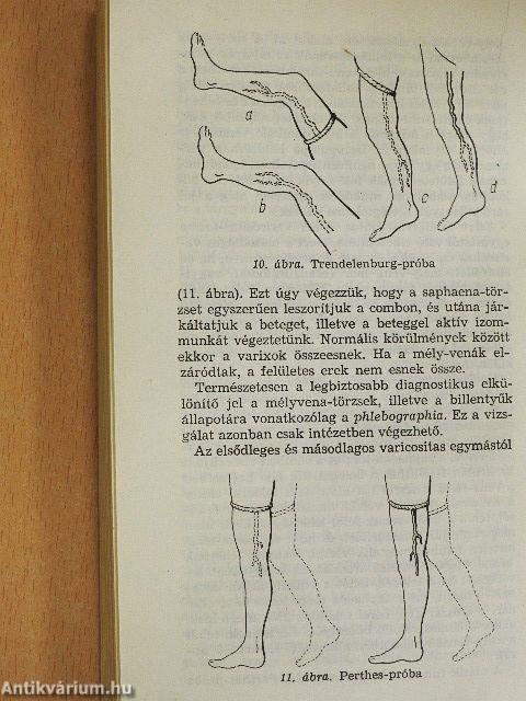 Sebészeti diagnostica a körzeti orvos számára