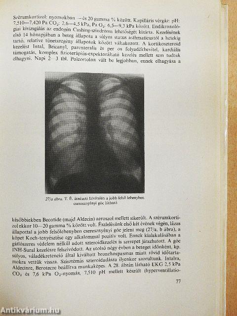 Asztmás betegek gyógykezelése és gondozása