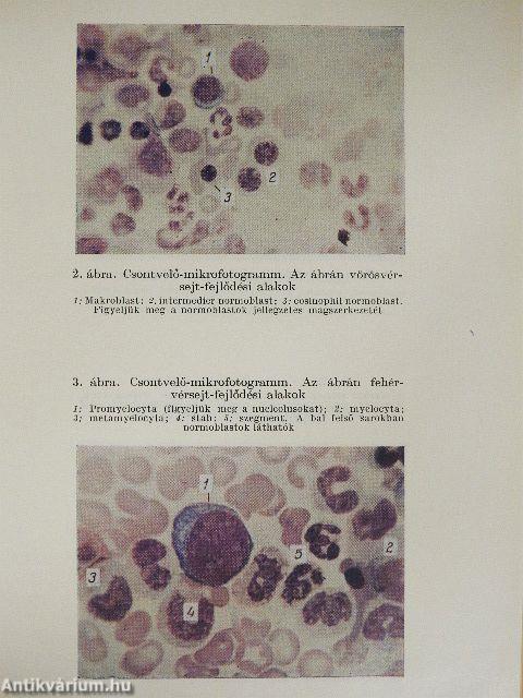 Kórélettani gyakorlatok