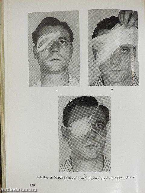 Szemészeti gyakorlatok