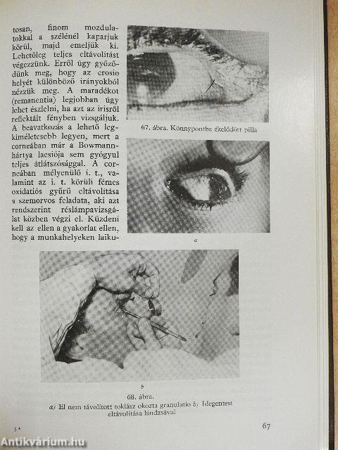 Szemészeti gyakorlatok