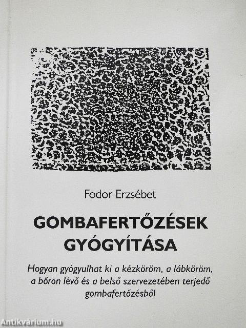 Gombafertőzések gyógyítása