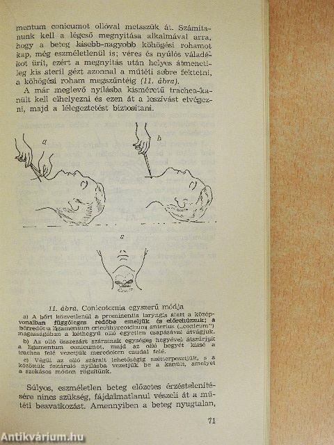 Életveszélyes állapotok körzeti orvosi ellátása