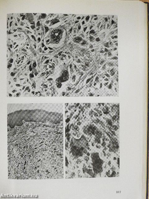 Kórszövettani gyakorlatok