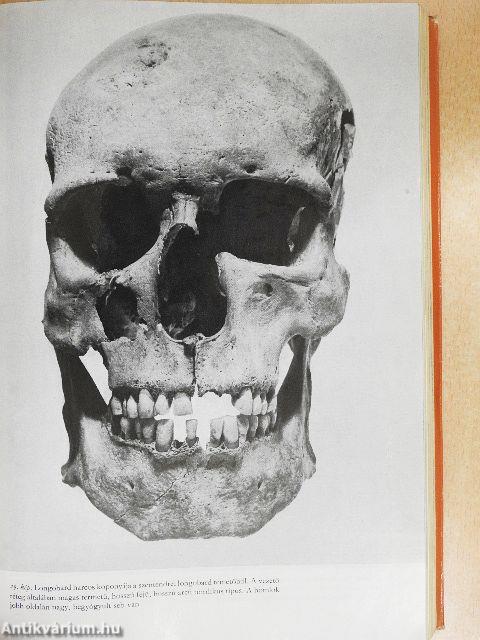 Sírok, csontok, emberek