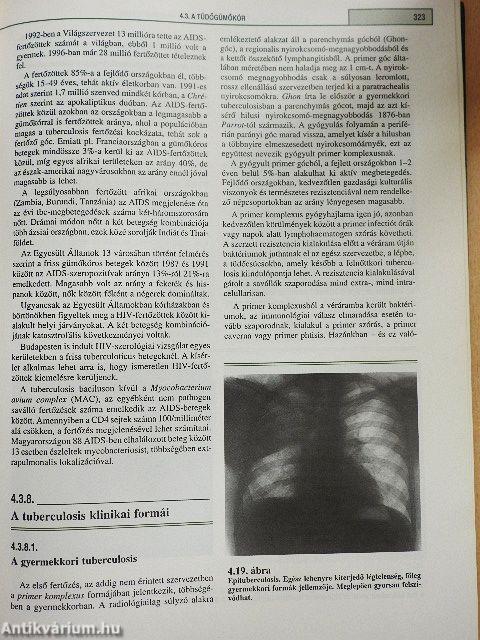 Pulmonológia