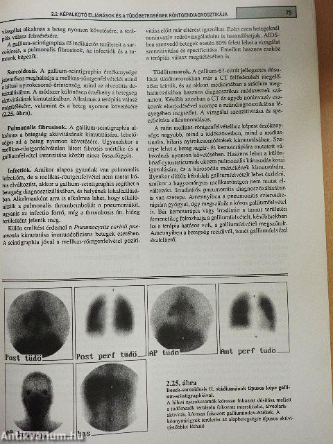 Pulmonológia