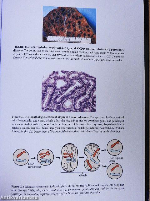 Rare Diseases and Orphan Drugs
