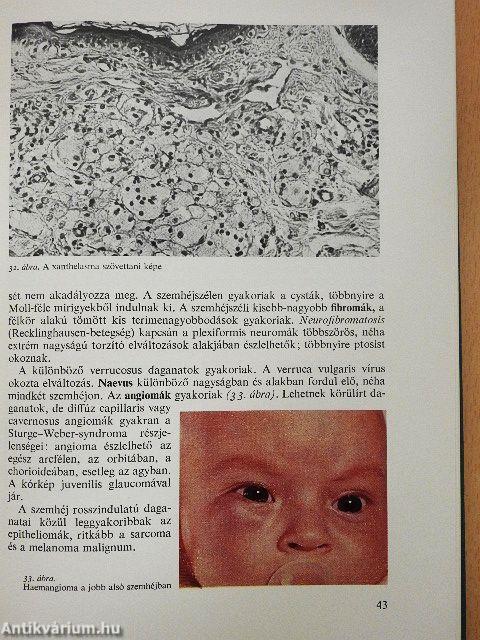 A szemészet alapvonalai 