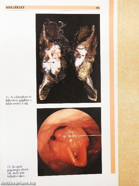 Miért ne dohányozzunk?