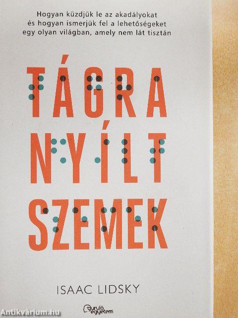 Tágra nyílt szemek