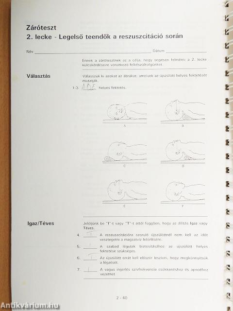 Újszülött újraélesztés