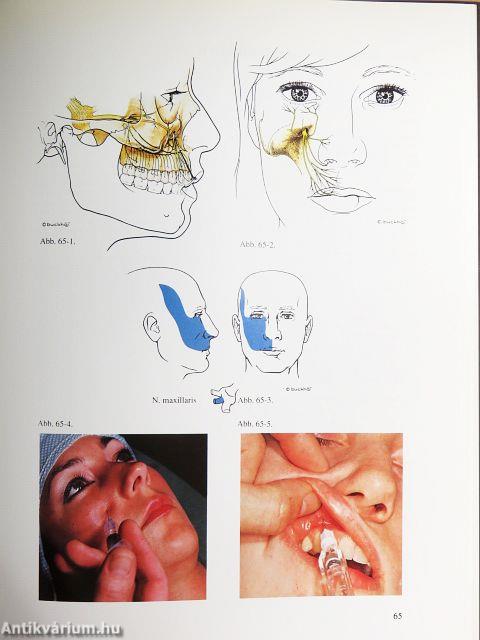 Techniken der Regionalanästhesie