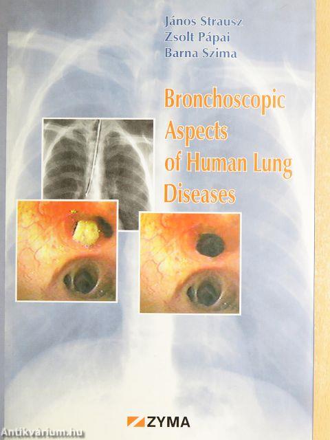 Bronchoscopic Aspects of Human Lung Diseases