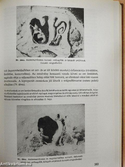 Sertésegészségtan