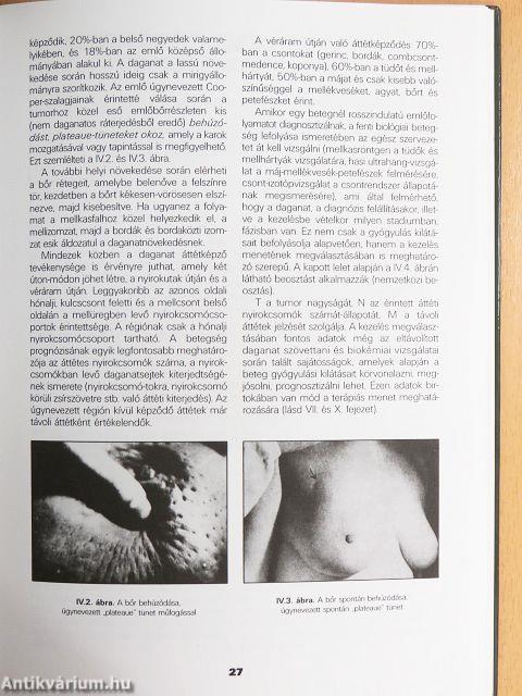 Amit az emlőről és betegségeiről tudni kell