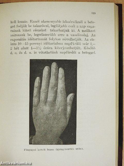 A napfény gyógyhatása és a napfürdő