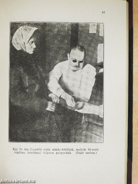 A napfény gyógyhatása és a napfürdő