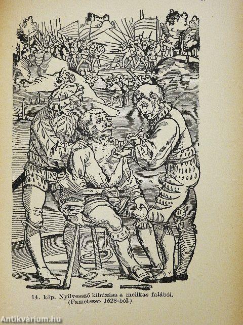 A sebészet diadalútja