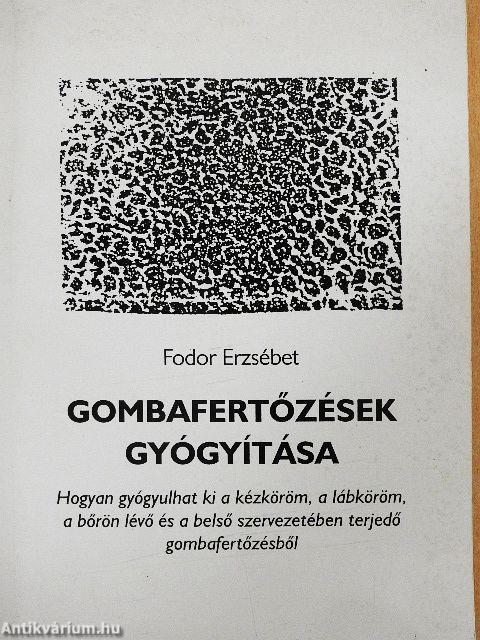Gombafertőzések gyógyítása