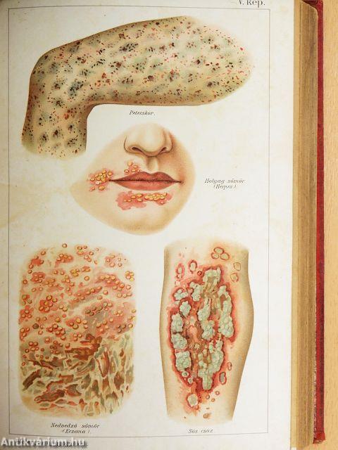 Az uj gyógymód I-II.