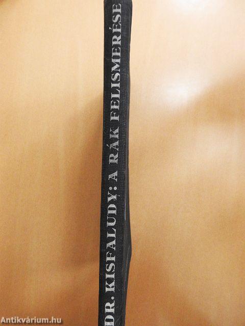 A rák felismerése és kezelése