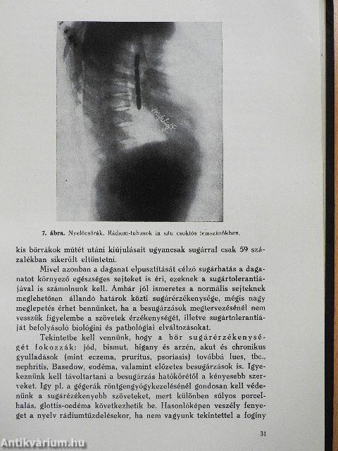 A rák felismerése és kezelése