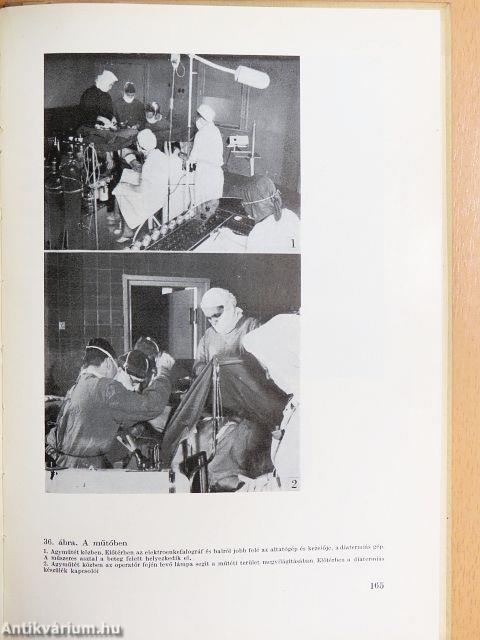 Az agysebészet története