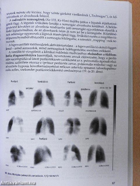 A nukleáris medicina tankönyve