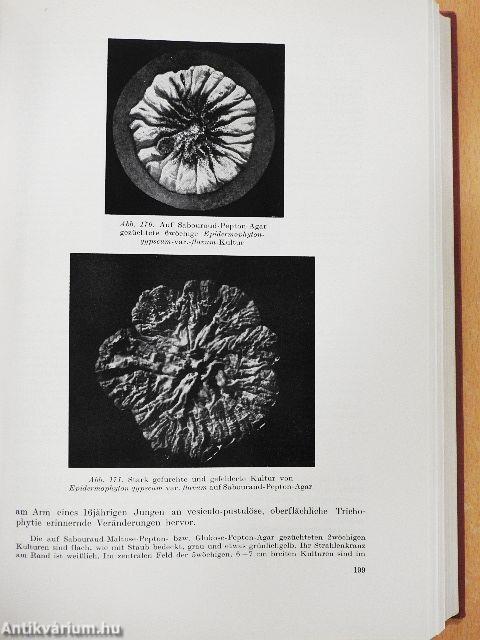 Medizinische Mykologie und Pilzkrankheiten