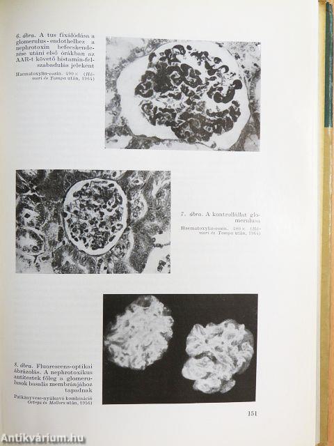 Belgyógyászati vesebajok