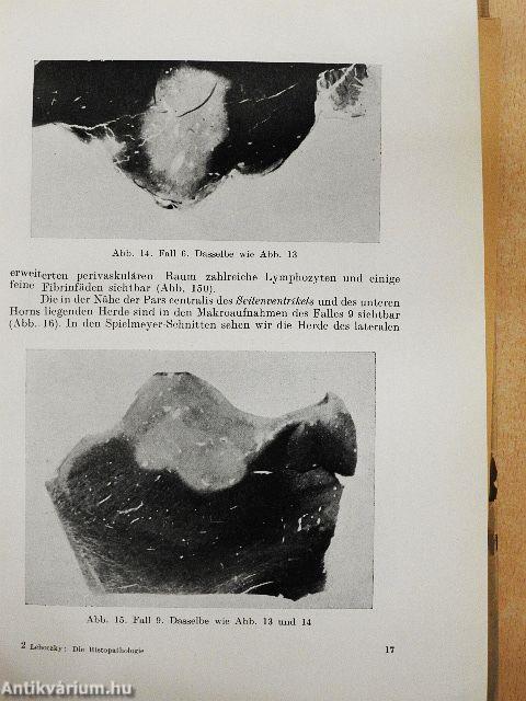 Die neuroallergischen Beziehungen in der Histopathologie der Multiplen Sklerose