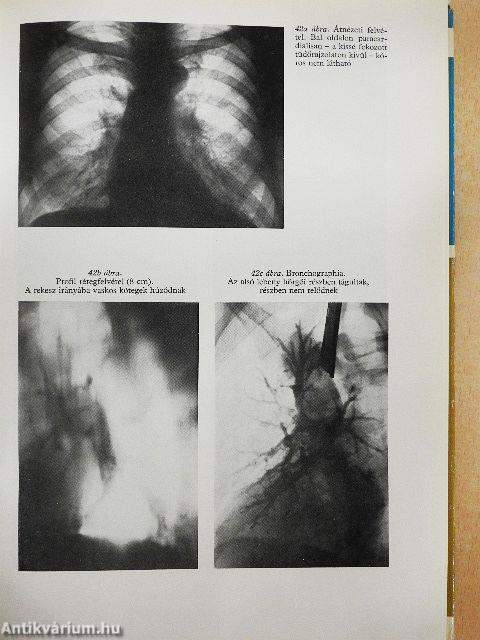 A felnőttkori tüdőbetegségek klinikuma