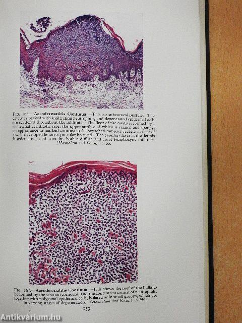 Atlas of Histopathology of the Skin