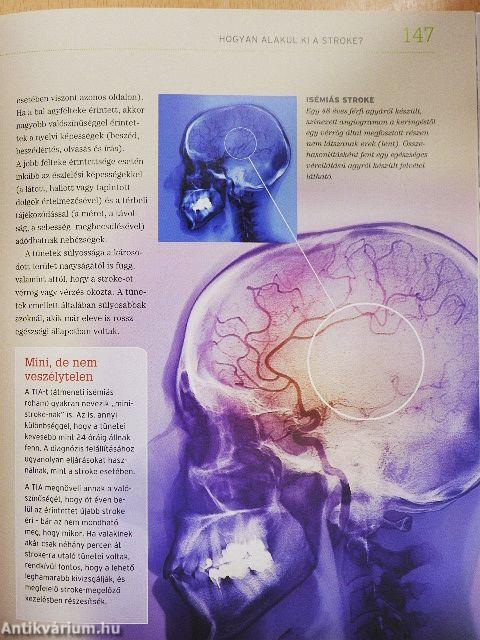 A gyors felépülés 1001 titka