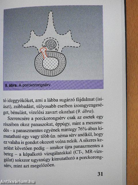 Derékfájás, isiász