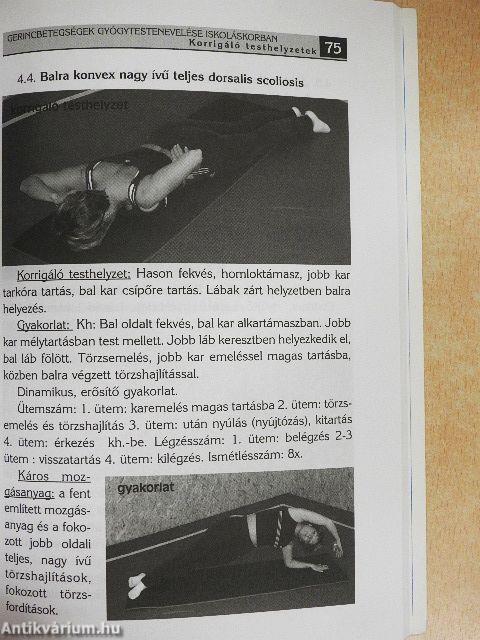 Gerincbetegségek gyógytestnevelése iskoláskorban