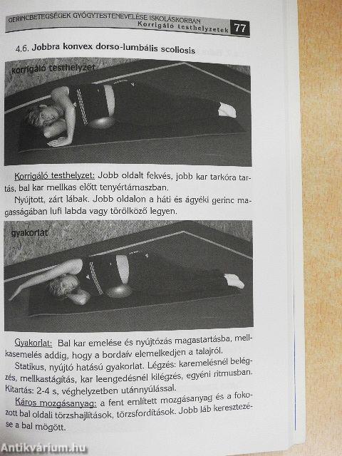 Gerincbetegségek gyógytestnevelése iskoláskorban