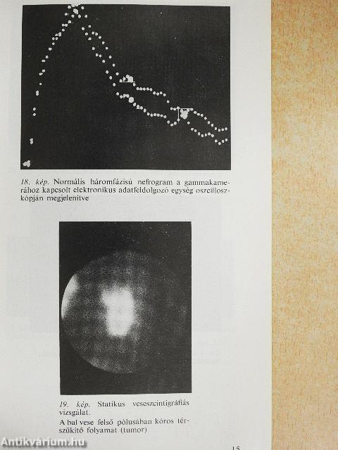 Orvosi izotóptechnika