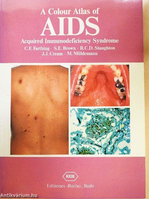 A Colour Atlas of AIDS