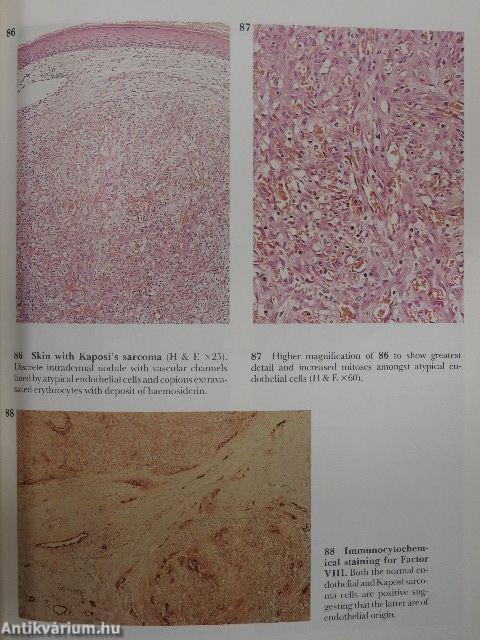 A Colour Atlas of AIDS