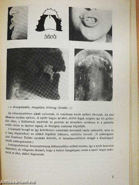 Helyes kiejtés, szép magyar beszéd