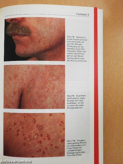 Dermatologie und Venerologie