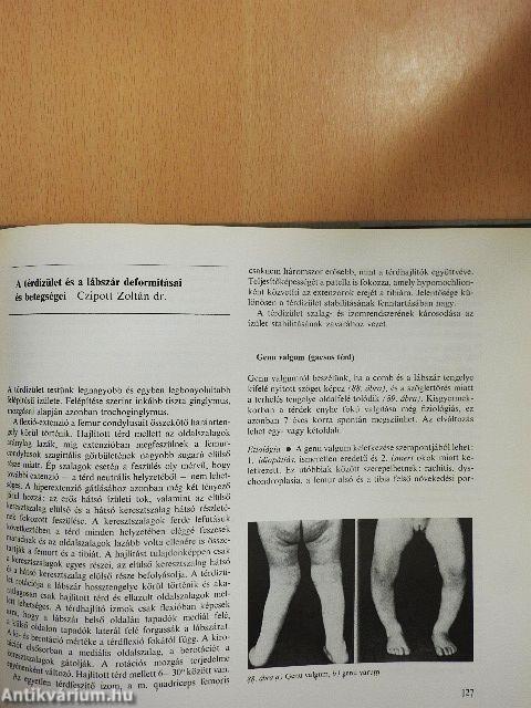 Az ortopédia tankönyve