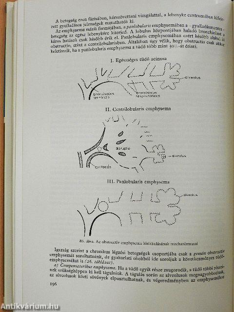 A felnőttkori tüdőbetegségek klinikuma