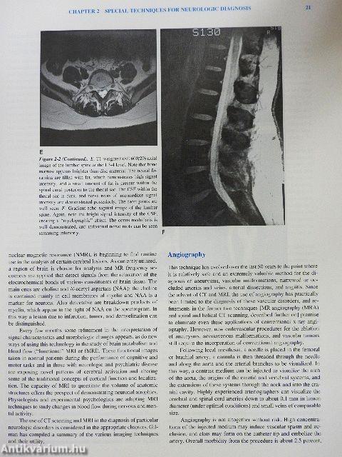 Principles of Neurology
