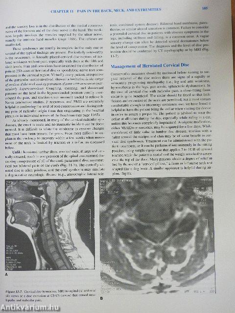 Principles of Neurology