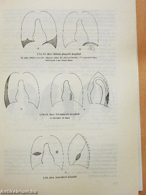 Klinikai röntgendiagnosztika