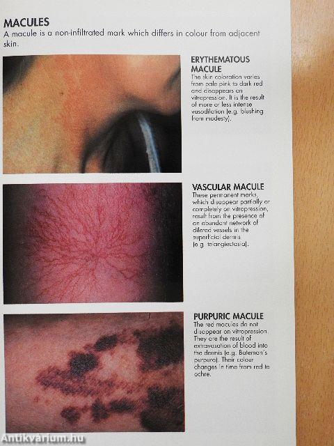 Atlas on Dermatology