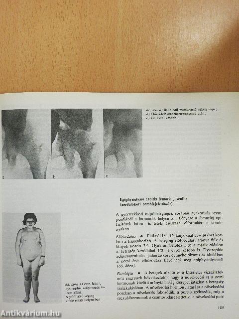 Az ortopédia tankönyve